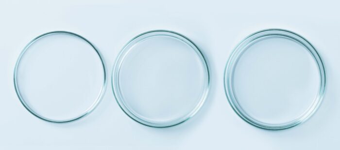 Commission proposes extension of IVDR transition periods for legacy products